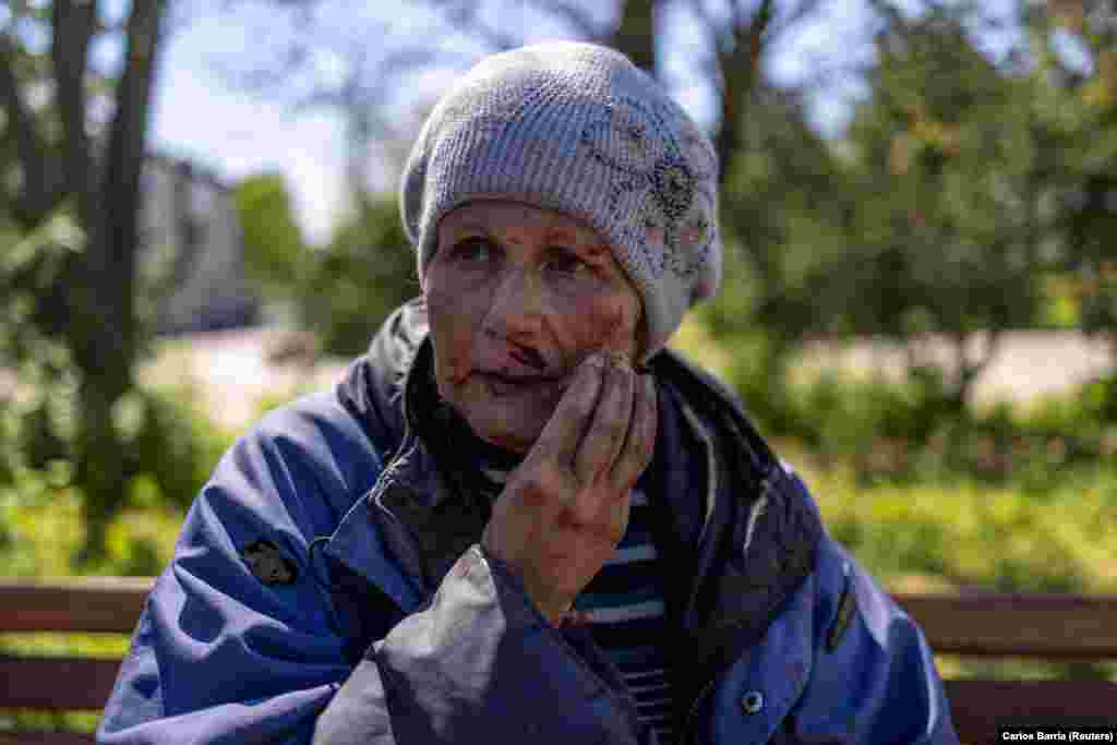 A woman injured during the Russian military strike sits outside the Kherson train station.