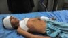 Afghan Bomb Kills Women, Kids