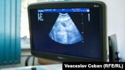 Diagnosticarea endometriozei implică mai multe etape. Una dintre acestea este efectuarea unei ecografii. 