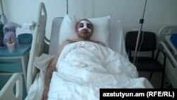 Nagorno-Karabakh - Hayk Khanumian, a Karabakh opposition politician, receives medical treatment in a Stepanakert hospital after being assaulted by a group of men, 6Jun2016.